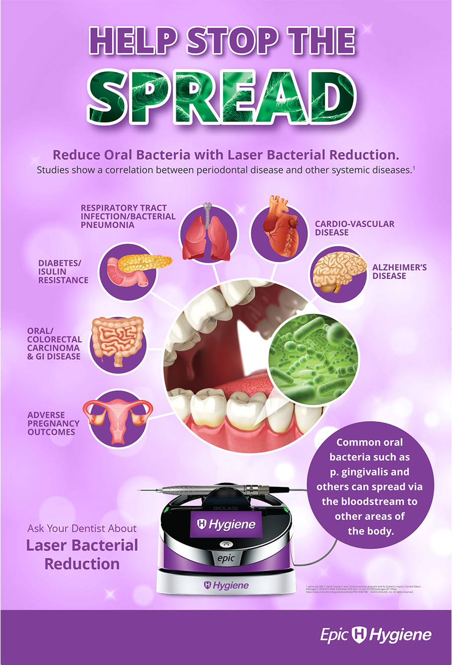 The image displays an informational graphic with a purple background featuring text and illustrations related to oral health and dental care, including images of teeth, gums, bacteria, and a depiction of a mouthwash product labeled  LASER BACTERIAL REDUCTION.  It also includes a call-to-action that says  HELP STOP THE SPREAD  and mentions  ORAL HEALTH,   BACTERIA,   GUMS,  and  MOUTHWASH.  The graphic is designed to promote dental hygiene practices.