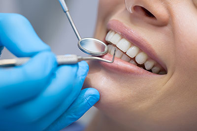 A dental hygienist performing a teeth cleaning procedure on a patient s mouth.