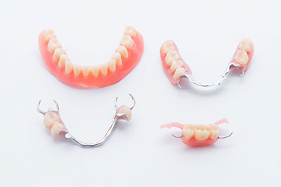 The image shows a set of dentures with visible teeth and gums, placed on a white background alongside a pair of metal clasps typically used for securing dentures.