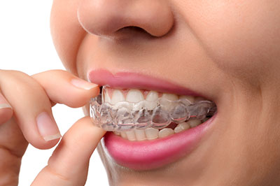 The image shows a person with braces holding their teeth together with both hands, displaying a smile with white teeth.
