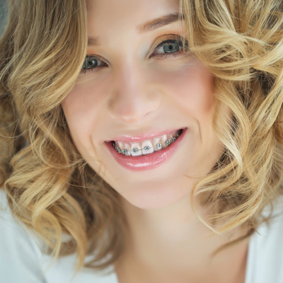 A smiling woman with braces, wearing a white top and wavy blonde hair.