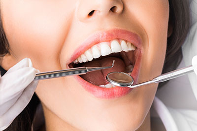 A woman with her mouth open wide, receiving dental treatment from a dental professional holding a drill, while she appears to be in pain or discomfort.