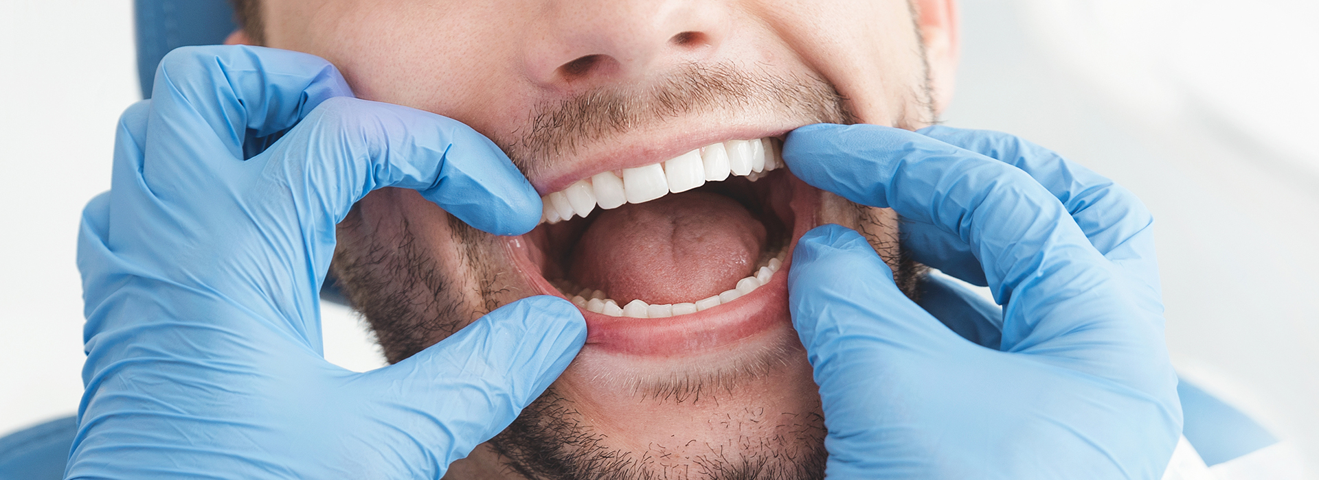 The image shows a person with their mouth wide open, surrounded by medical equipment including blue gloves and a dental mirror, likely in a dental or medical setting.