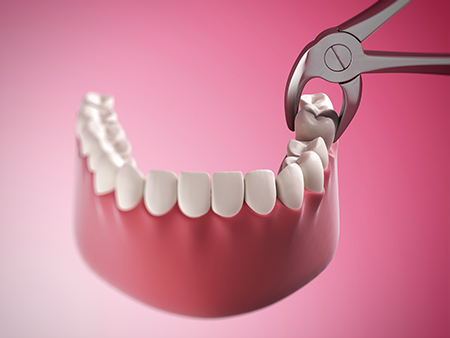 The image depicts a dental tool, specifically a pair of scissors, being used on an artificial tooth structure with visible teeth and gums, against a pink background.
