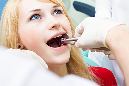 A woman receiving dental care with her mouth open while sitting in a dentist s chair.