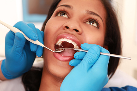 A woman receiving dental care with her mouth open while wearing blue gloves by a dental professional.