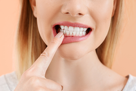 A woman with her finger on her teeth, smiling broadly, against a plain background.